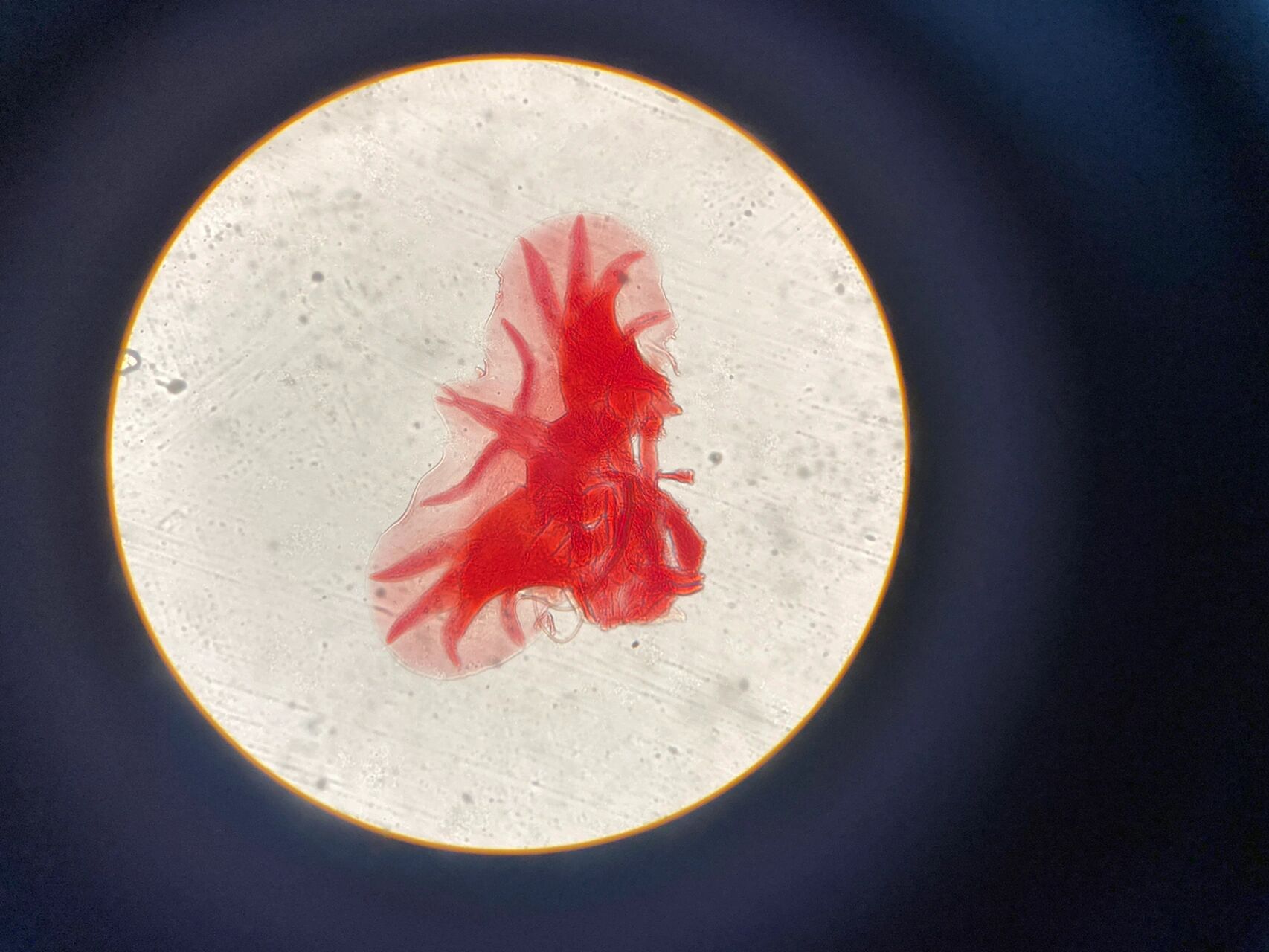 28 钩虫 蛲虫 绘图: 旋毛虫幼虫囊包 美洲钩虫口囊 十二指肠钩虫口囊