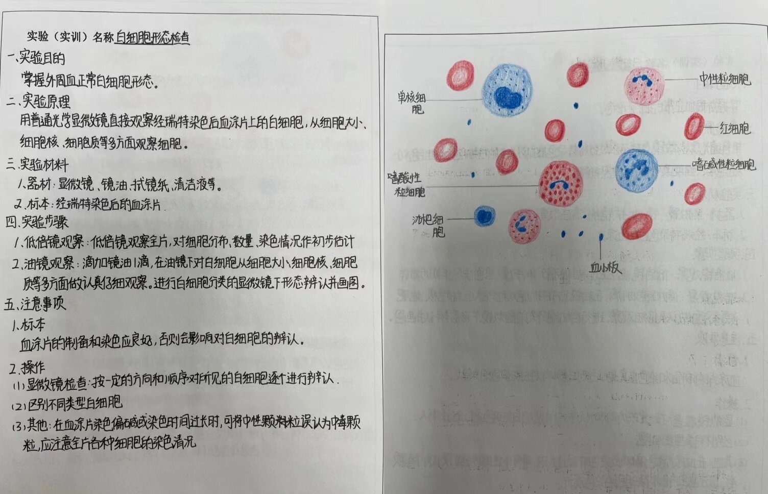 5种白细胞形态绘图图片