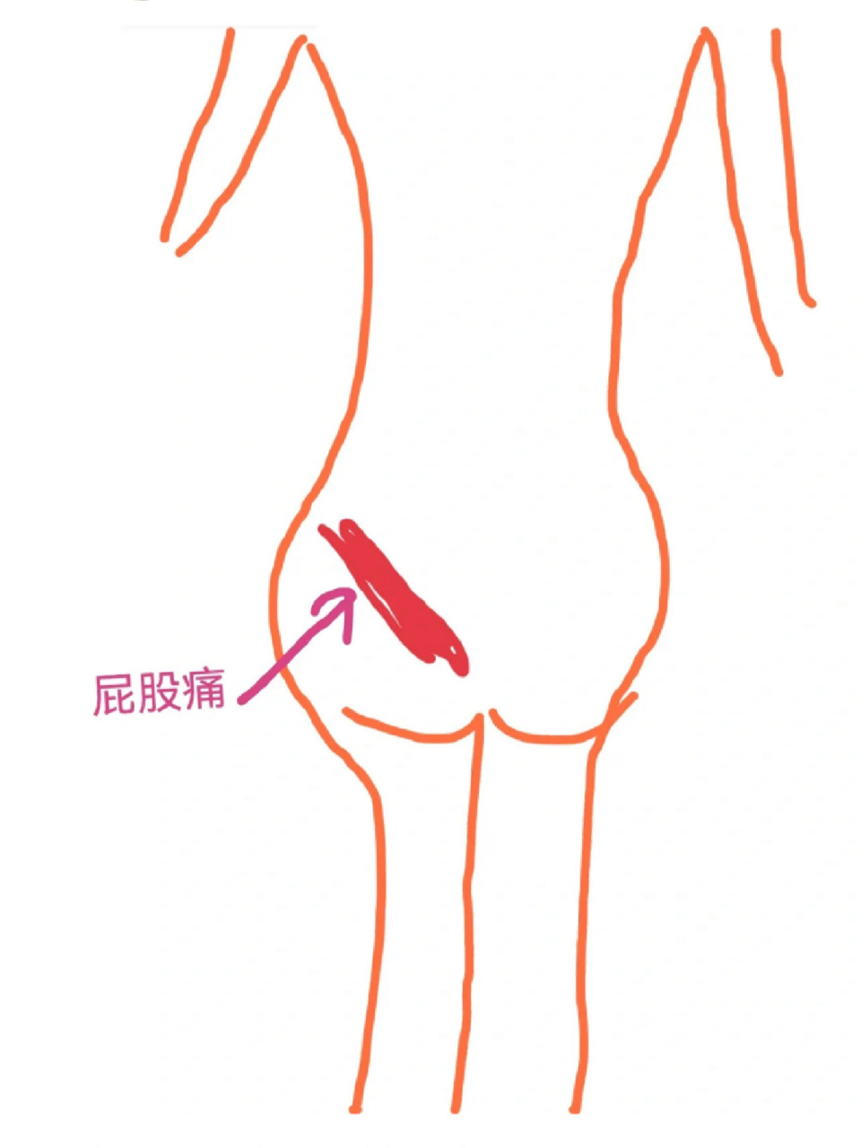 为什么屁股眼总是擦不干净为什么在线