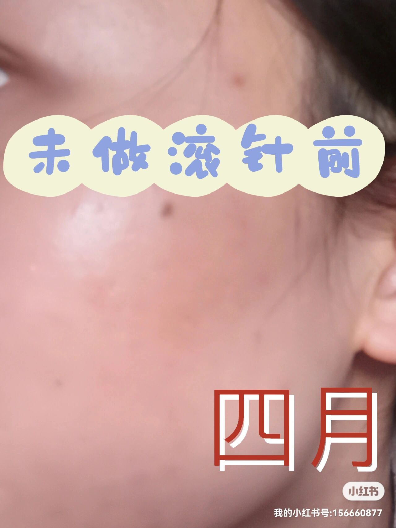 滚针几次可以看到效果