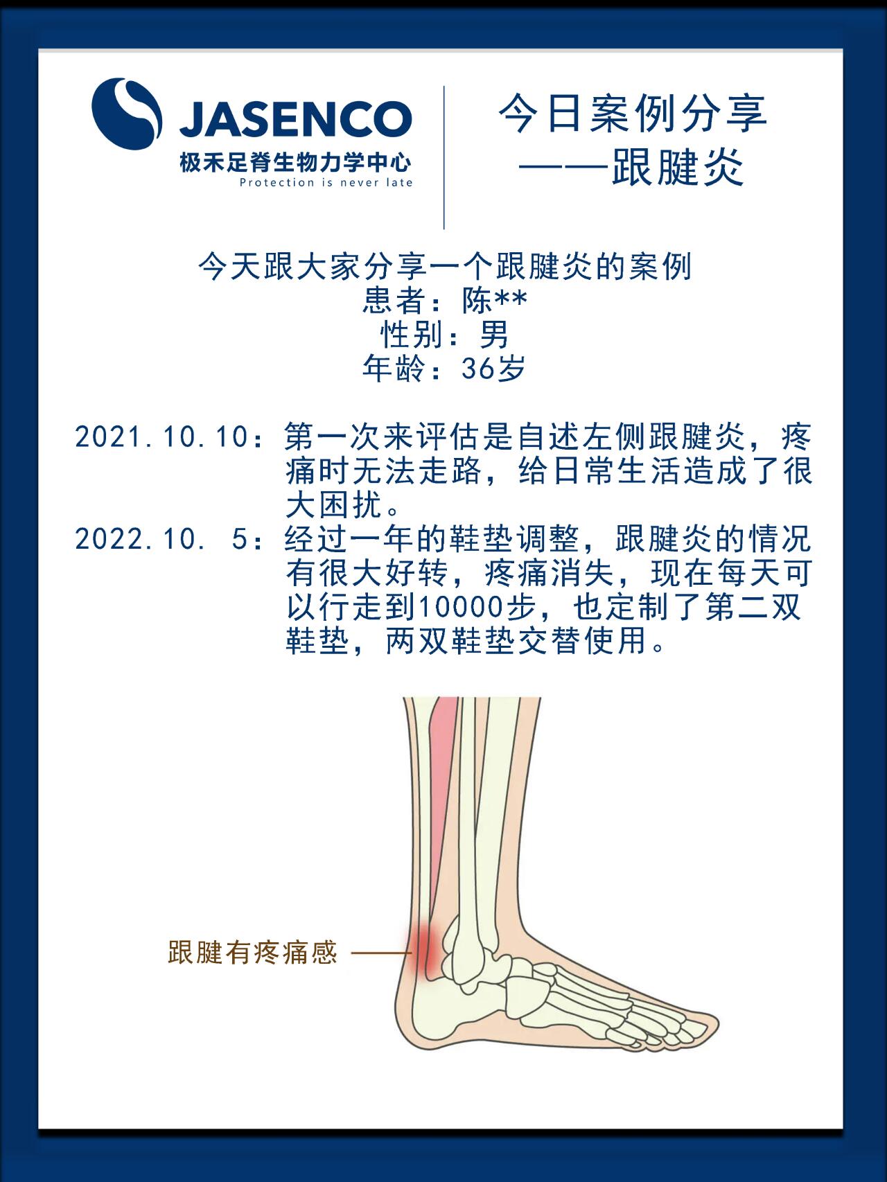 今天就来分享一种轻松治疗跟腱炎的方法!