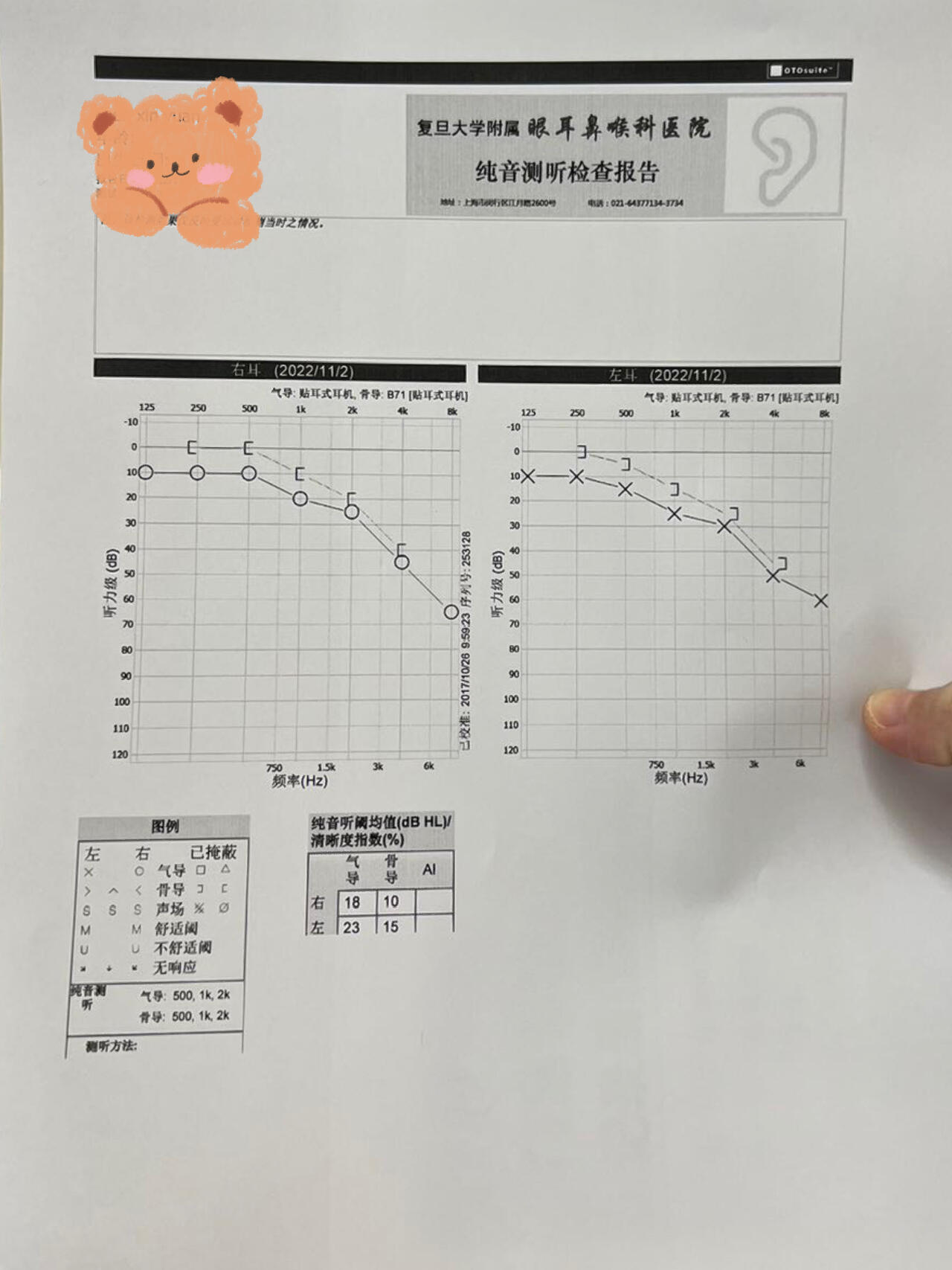 听力测试报告