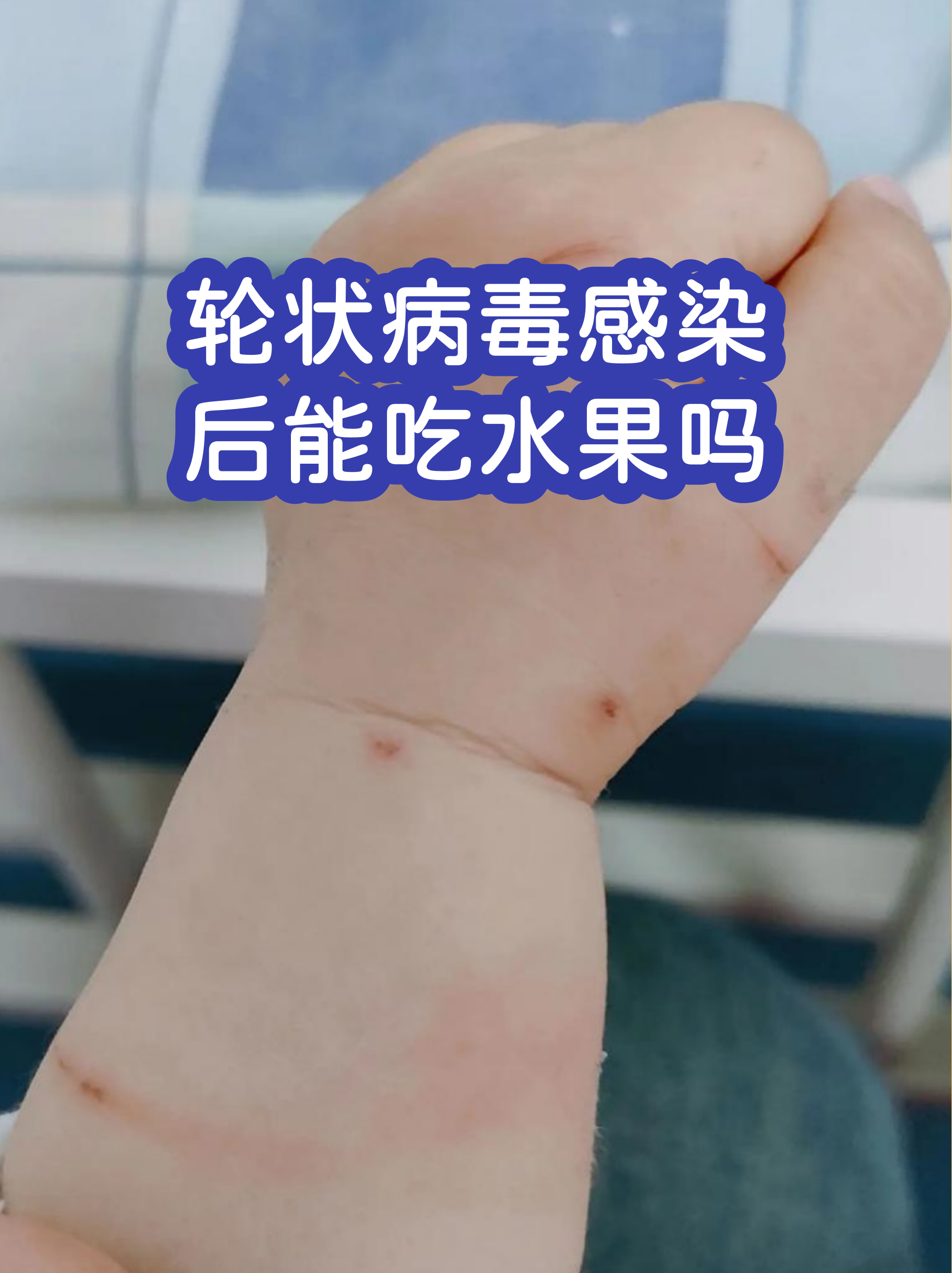  现在什么水果有病毒(什么水果有新型冠状病毒)