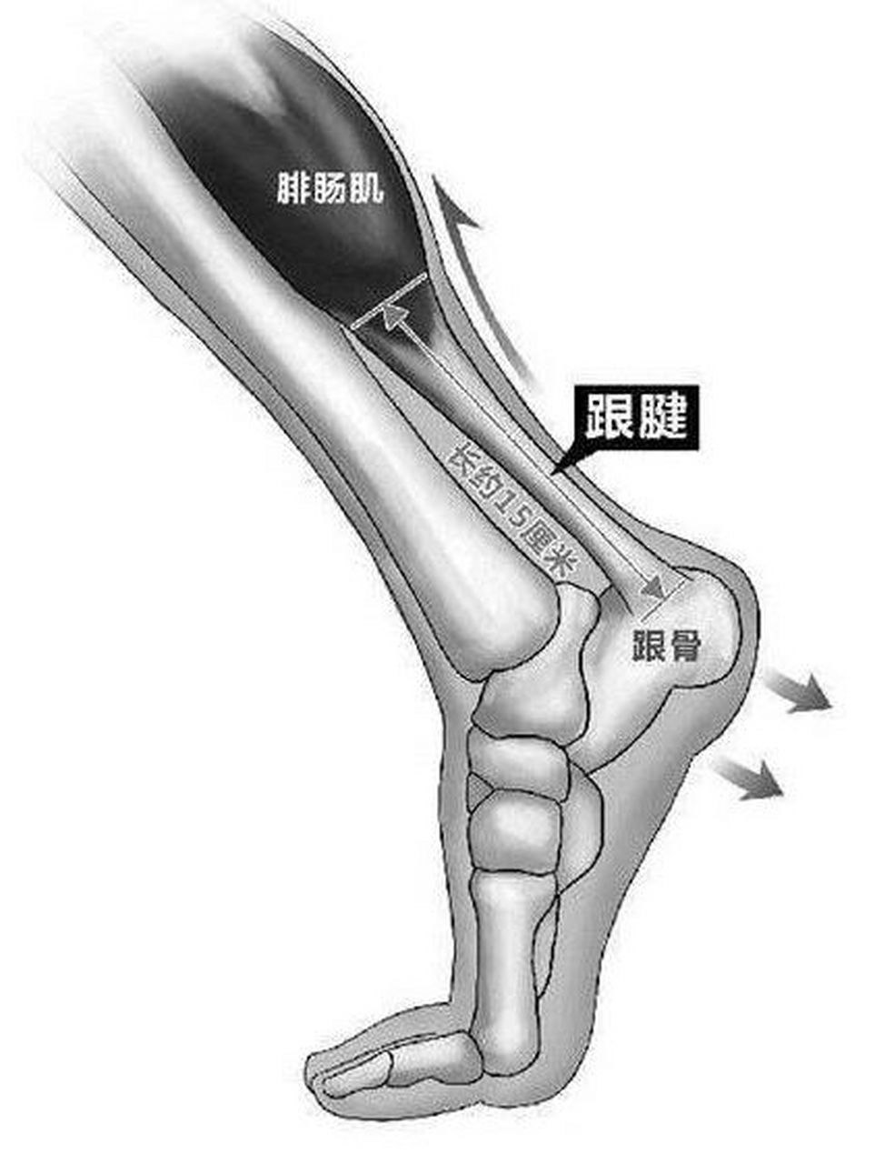 跟腱炎 跑友最容易得跟腱炎: 骨头是人体的框架和大梁,骨头本身不会