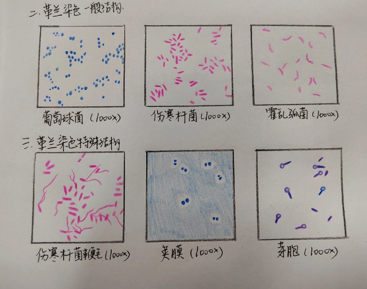 肺炎杆菌手绘图图片