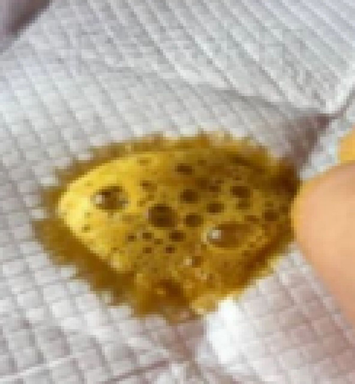 摄入母乳中的乳糖过多 母乳喂养的宝宝拉泡沫状大便很大的原因