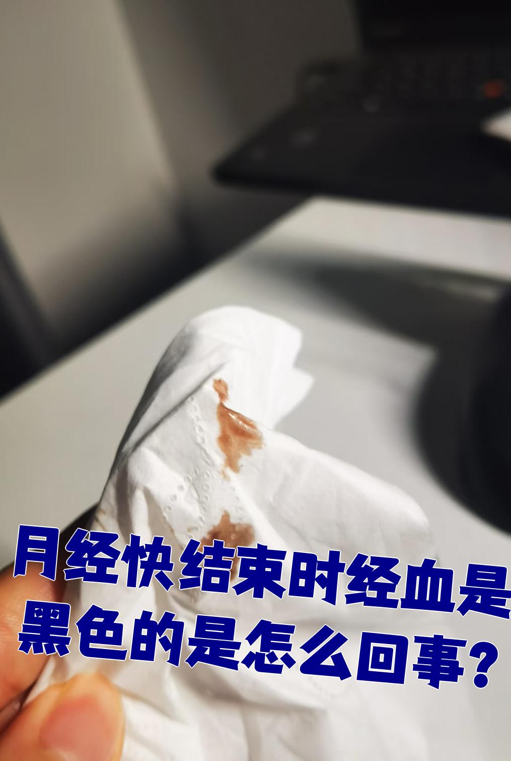 月经快结束时有黑色经血,这可能是正常现象,也可能是身体受凉导致的