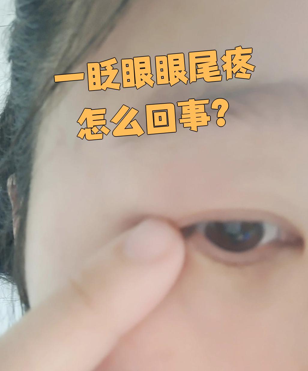 一眨眼眼尾疼怎么回事?