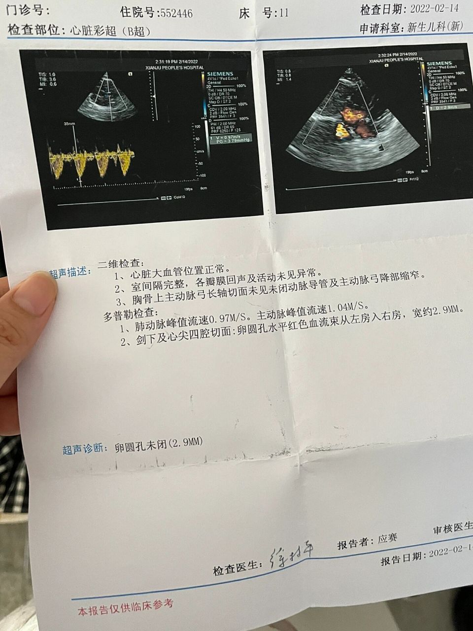 心脏彩超复查卵圆孔闭合 月子里在医院检查出卵圆孔未闭,(2.9mm)医生