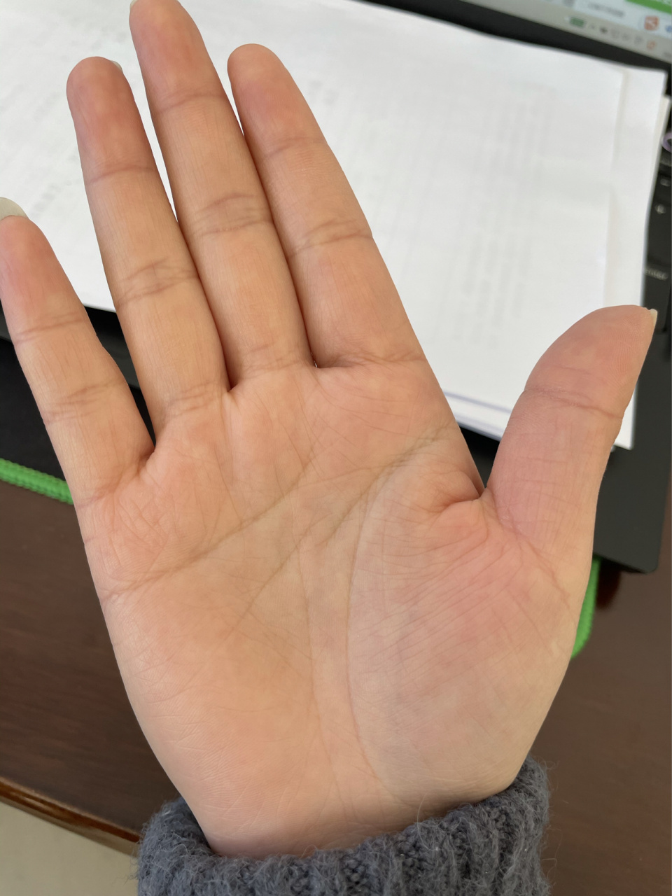 两个手掌掌纹,右手中间怎么断了. 右手掌中间那条线是断的么?