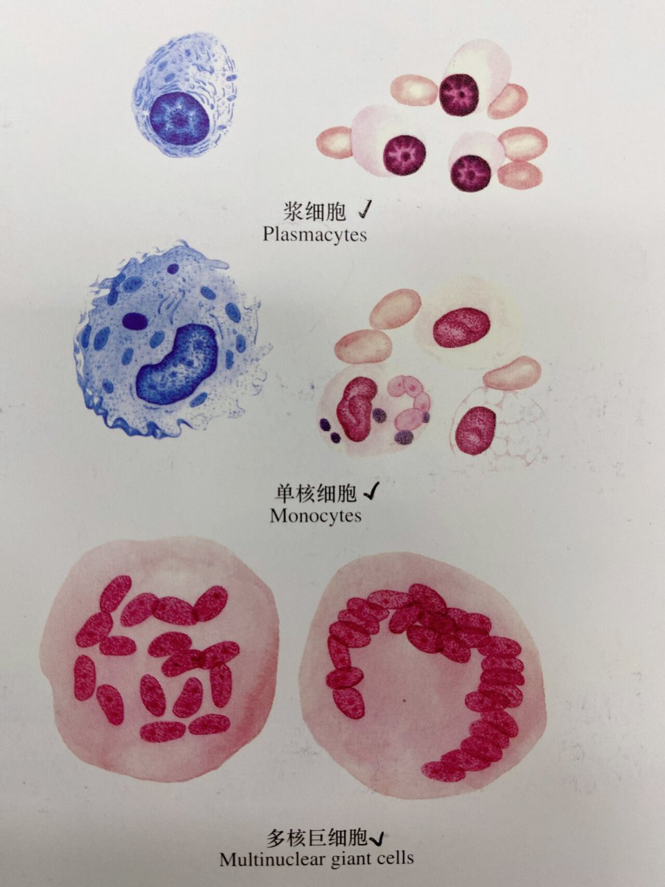 各种炎细胞图片