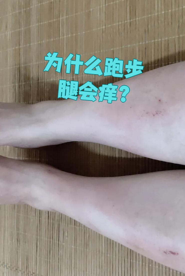 为什么腿很痒