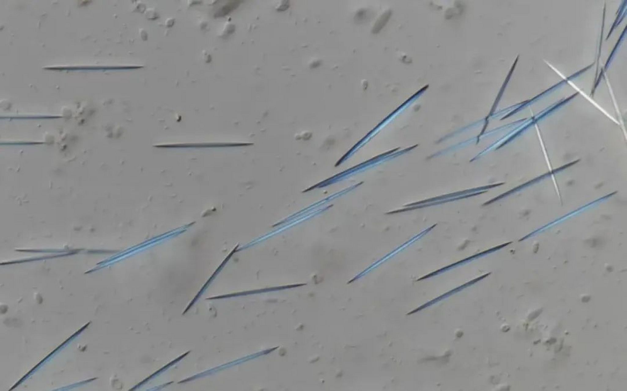 显微镜下的菠萝切片中 全是针尖状的草酸钙结晶  .