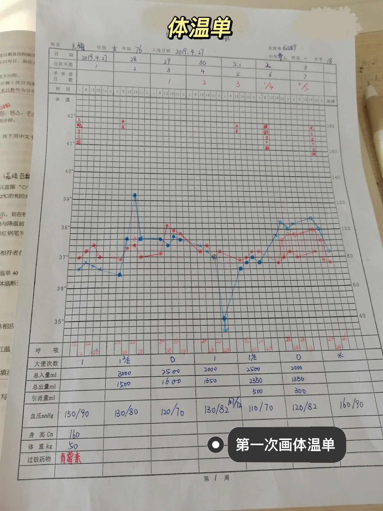 体温单绘制图解图片