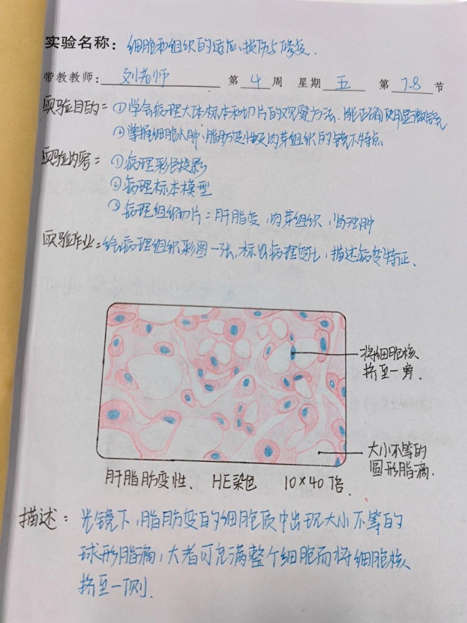 病理学 脂肪肝变形 绘图 红蓝铅笔实验报告 红蓝铅笔he染色脂肪肝变性