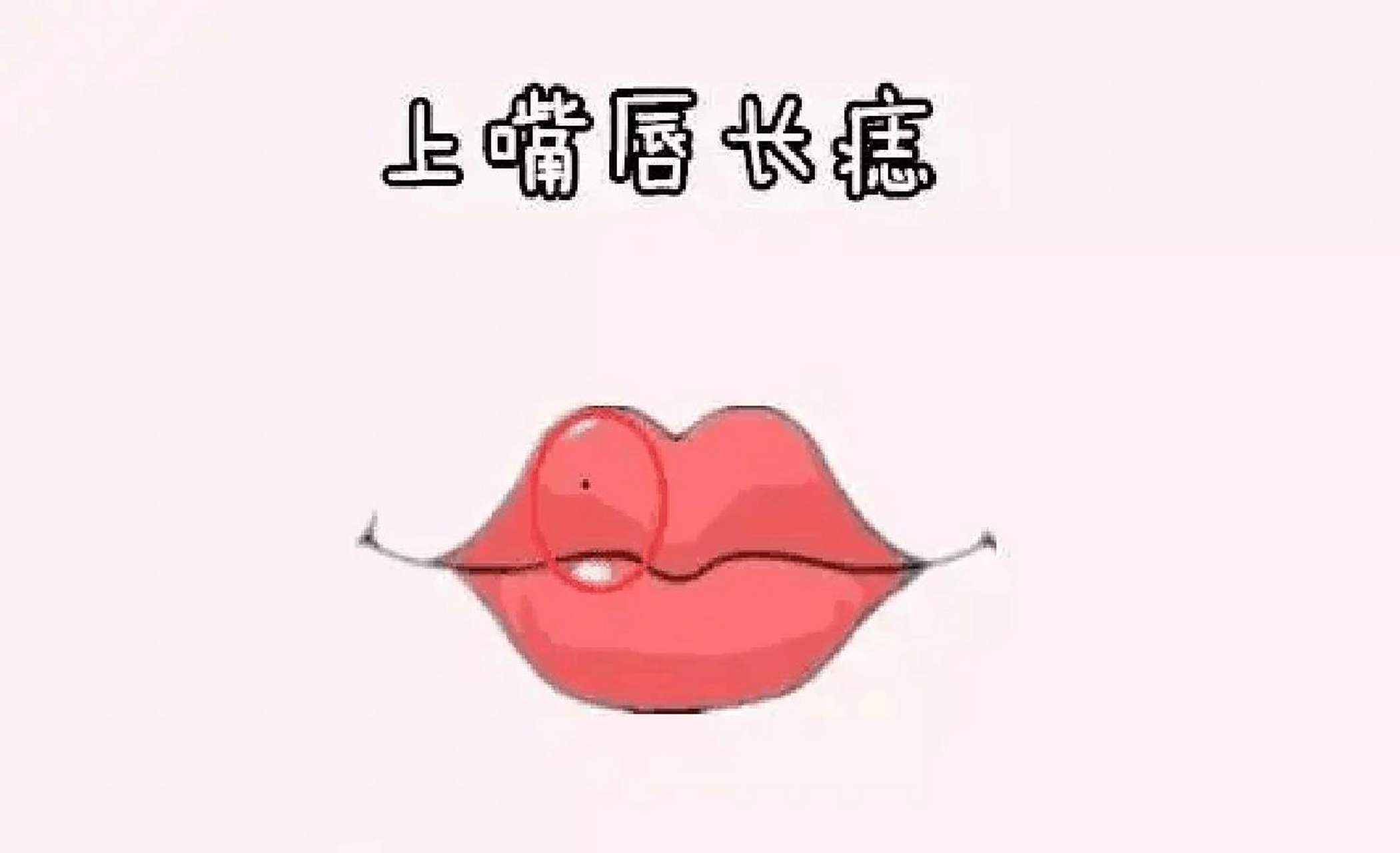 上嘴唇有痣好吗 上嘴唇有痣好吗 上嘴唇正中间有痣 嘴唇开要圆,合要方