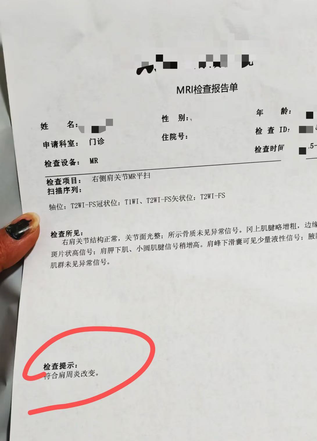 的原因有生理性弹响,肩部肌肉痉挛,肩胛骨陈旧性损伤,筋膜炎,肩周炎等