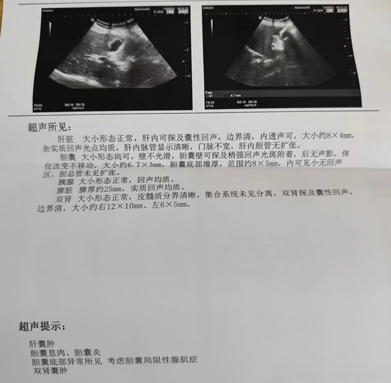 健闻登顶计划#   从您的超声报告来看不严重