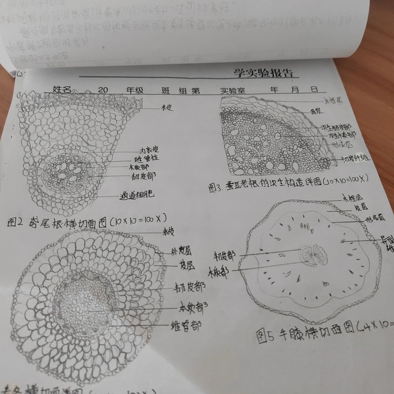 根尖图手绘图片