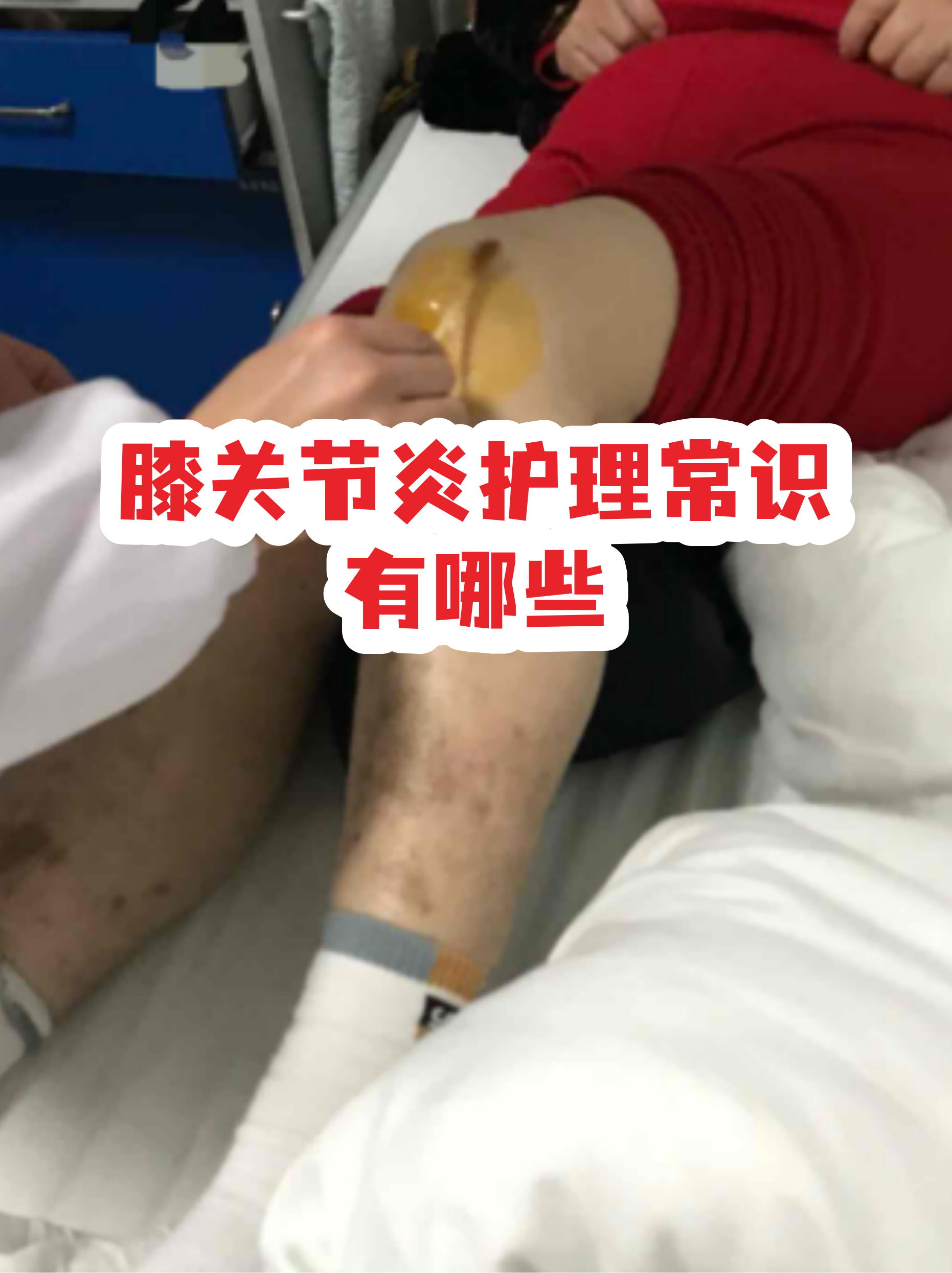 包含佑安医院代诊挂号服务术后居家护理指导，减少复发风险的词条