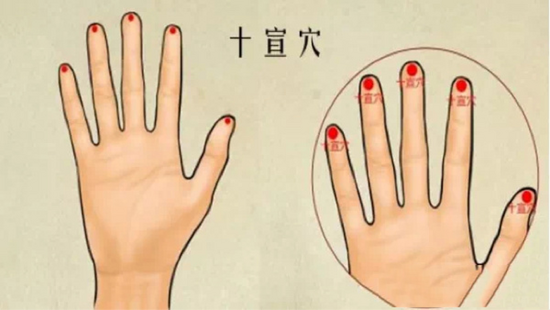 手指放血的位置示意图图片