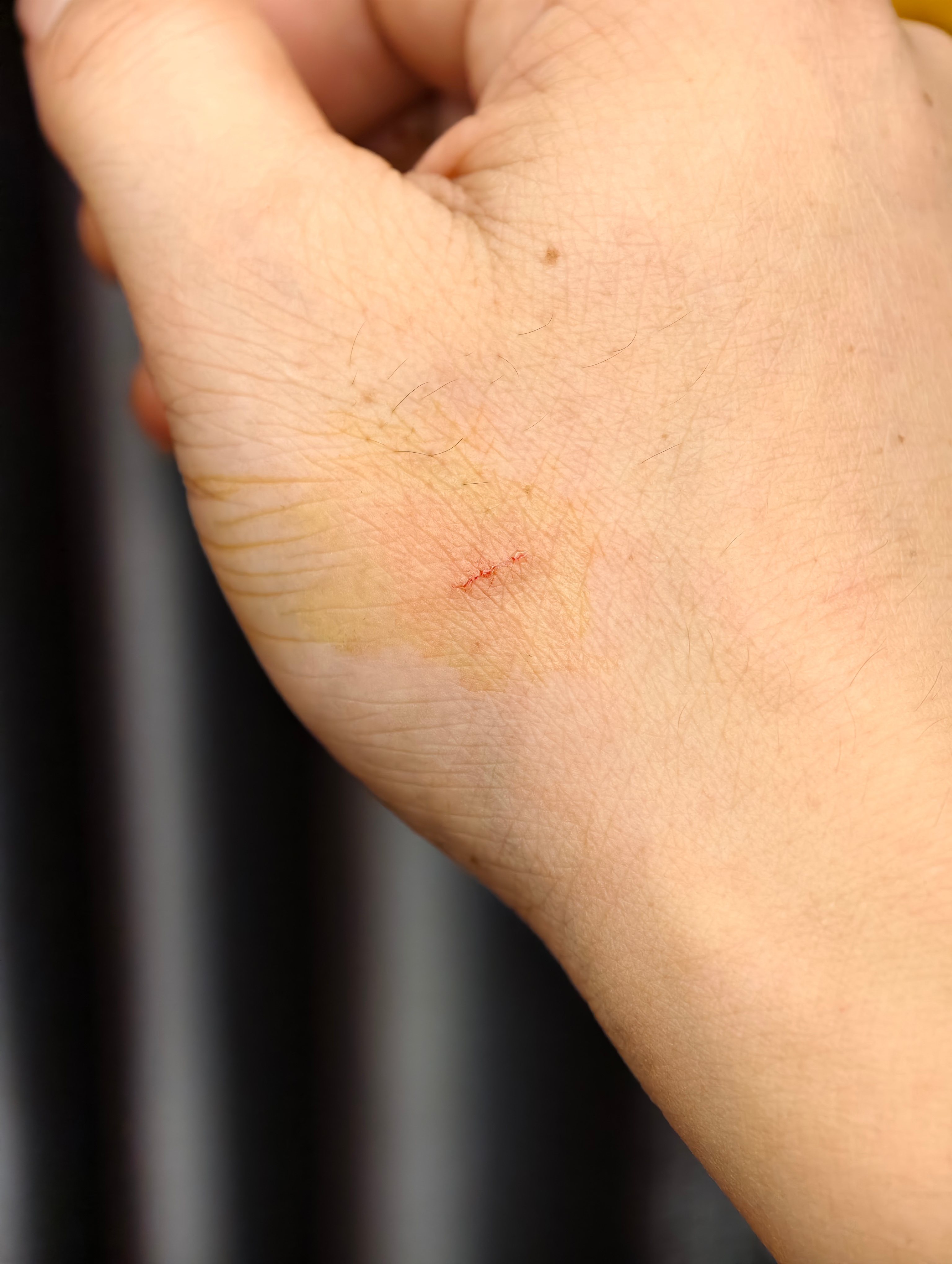 被家里的猫抓了,两年前打过狂犬疫苗,还用不用再打?