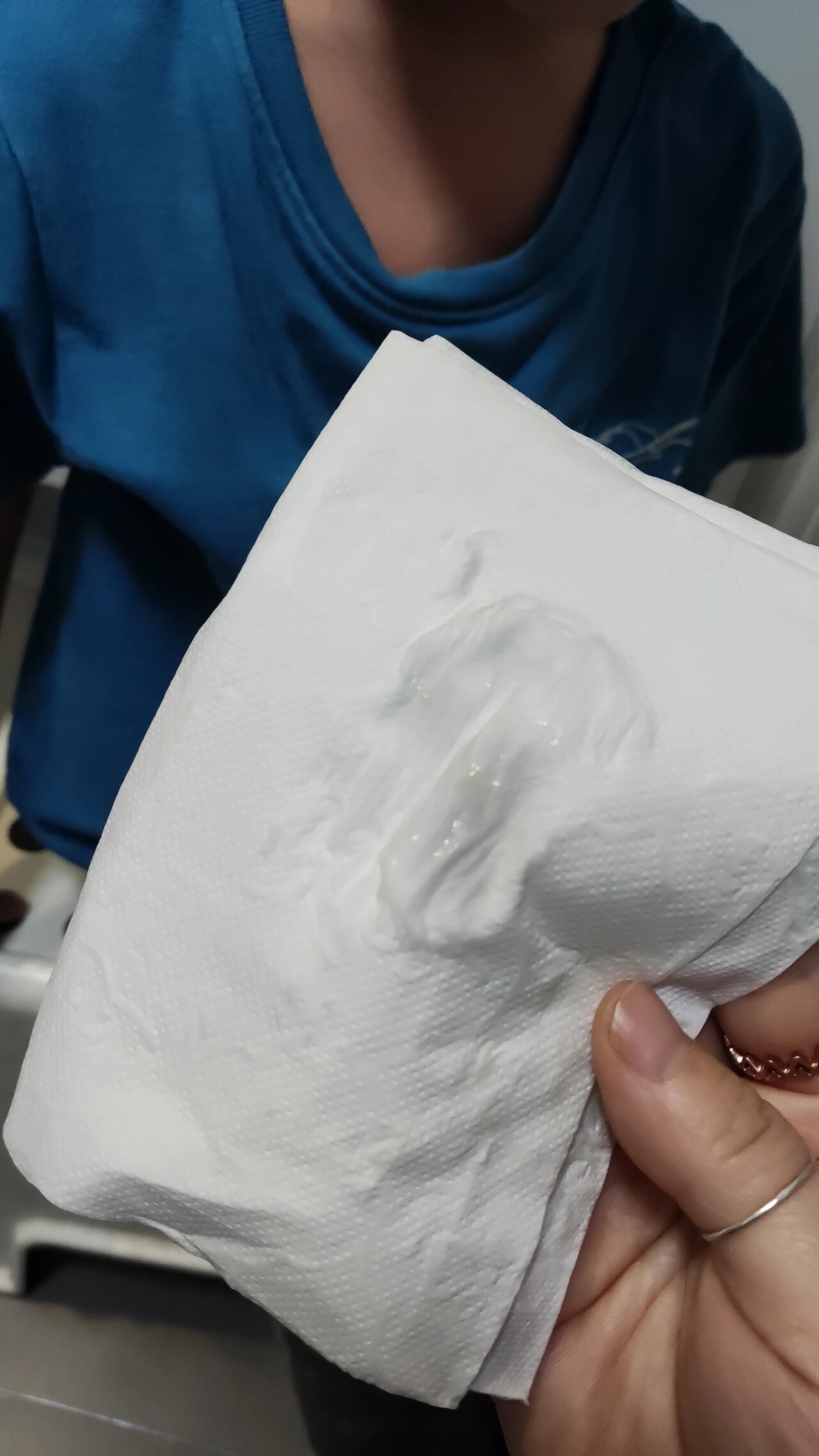 昨天黄脓鼻涕超级多,还有一点低烧,按压脸颊会疼,典型的鼻窦炎症状.