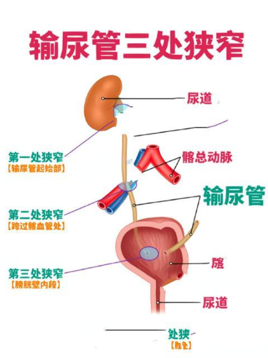 所以术后需要特别注意护理,并且要按时复查