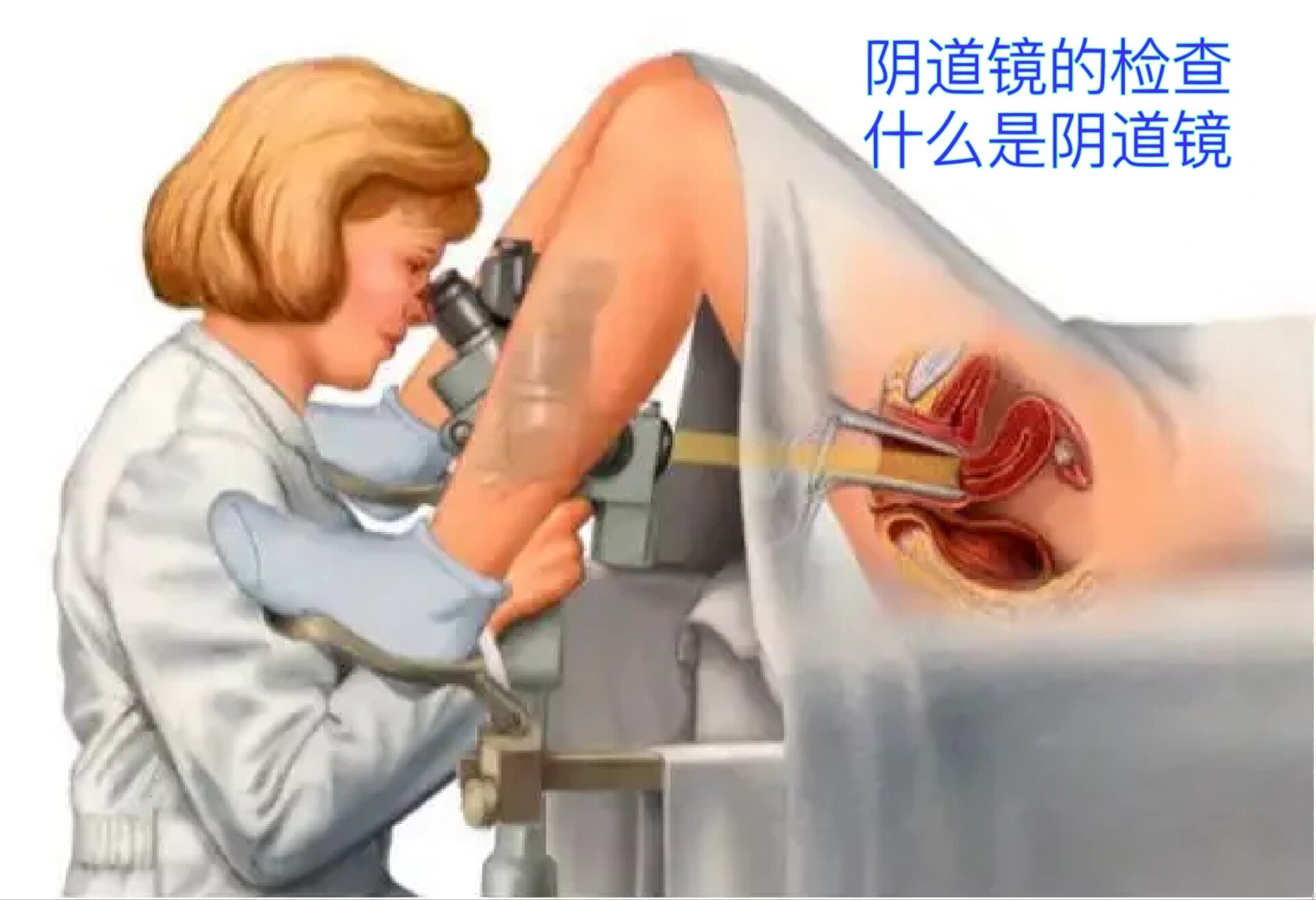 什么是阴道镜 阴道镜是一种妇科内窥镜,通俗的讲,是一个用于诊断宫颈