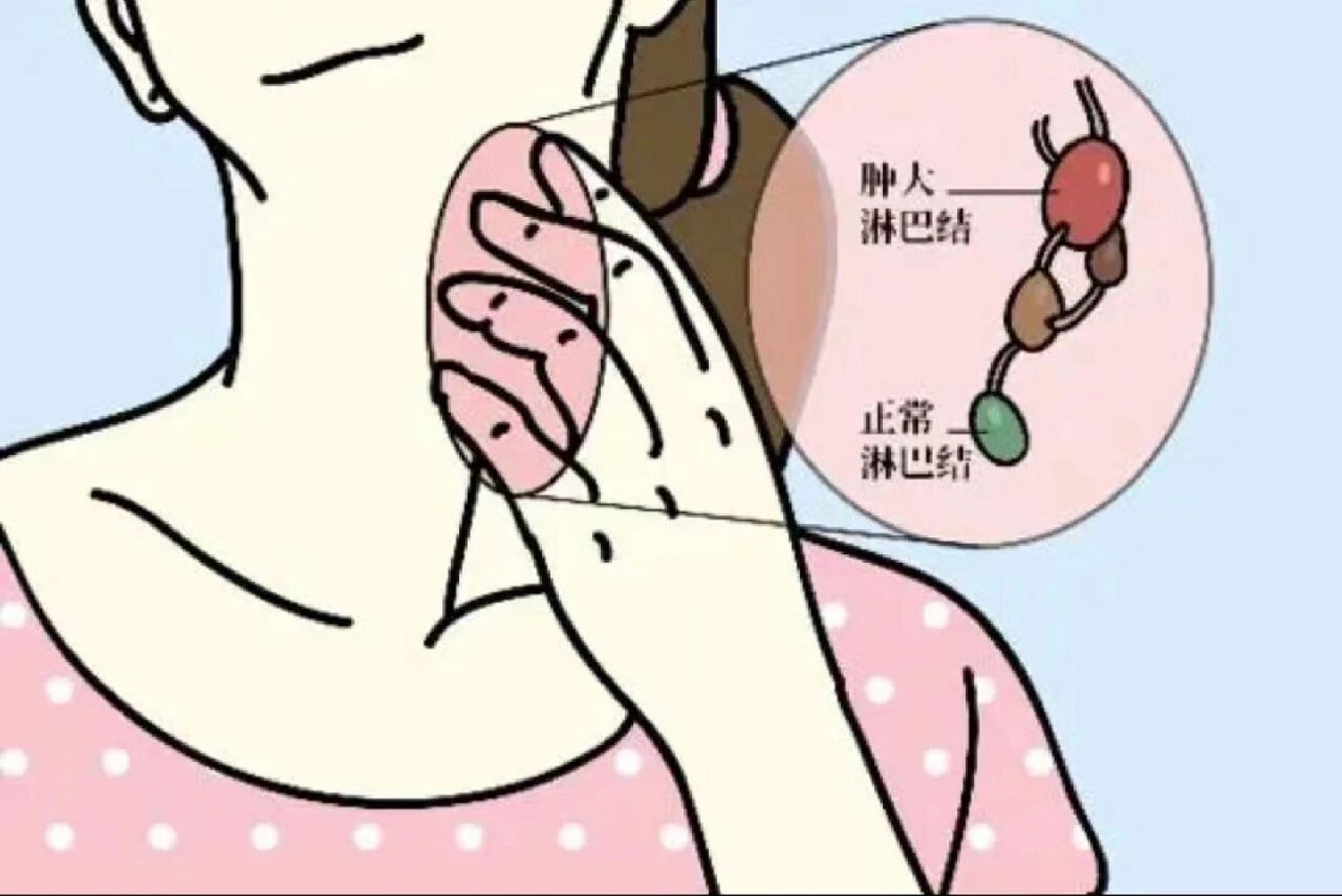 这是乳腺癌,淋巴癌的警号!乳房的毒素没有