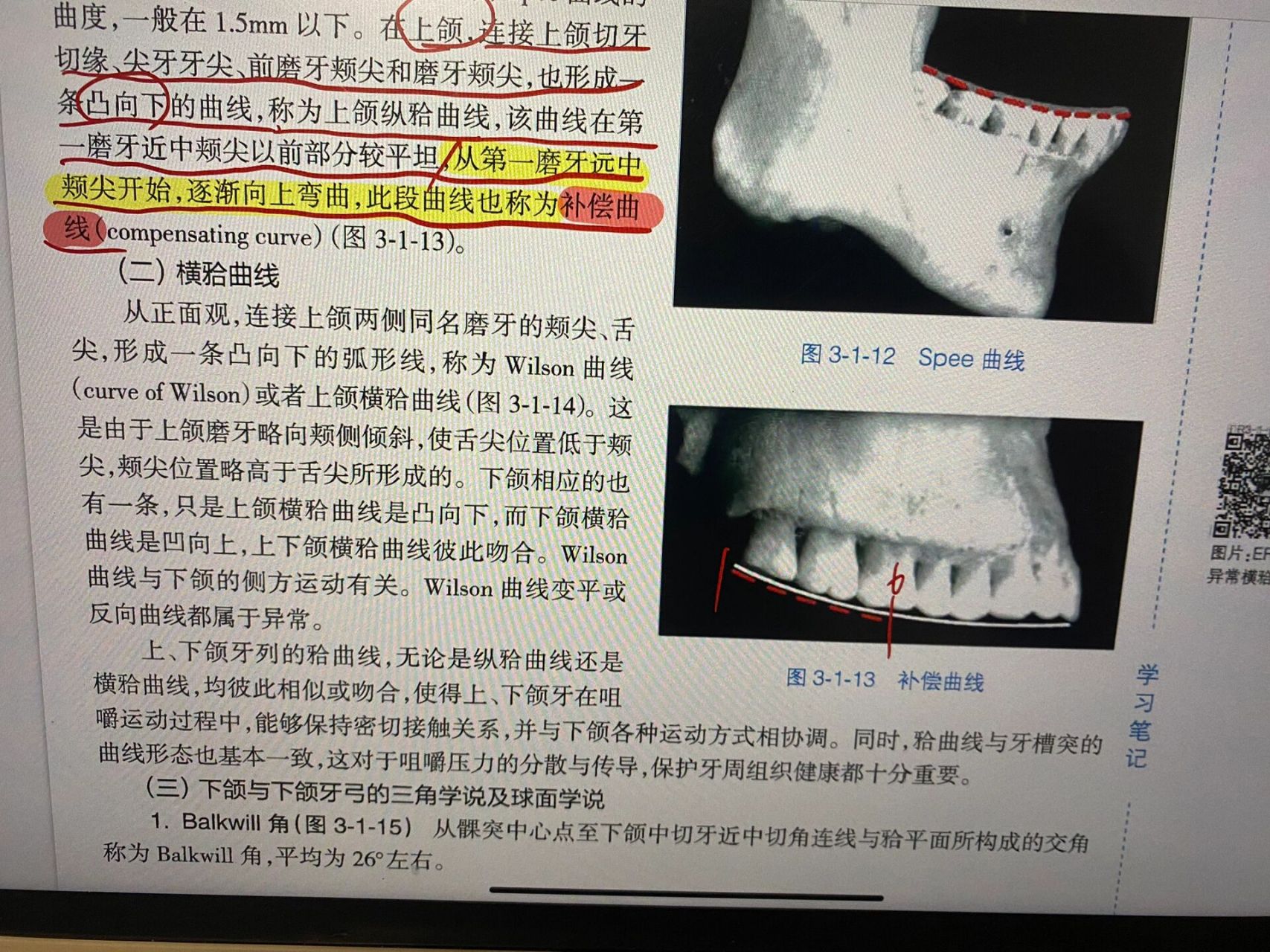 补偿曲线到底是什么? 麻了麻了我真的麻了