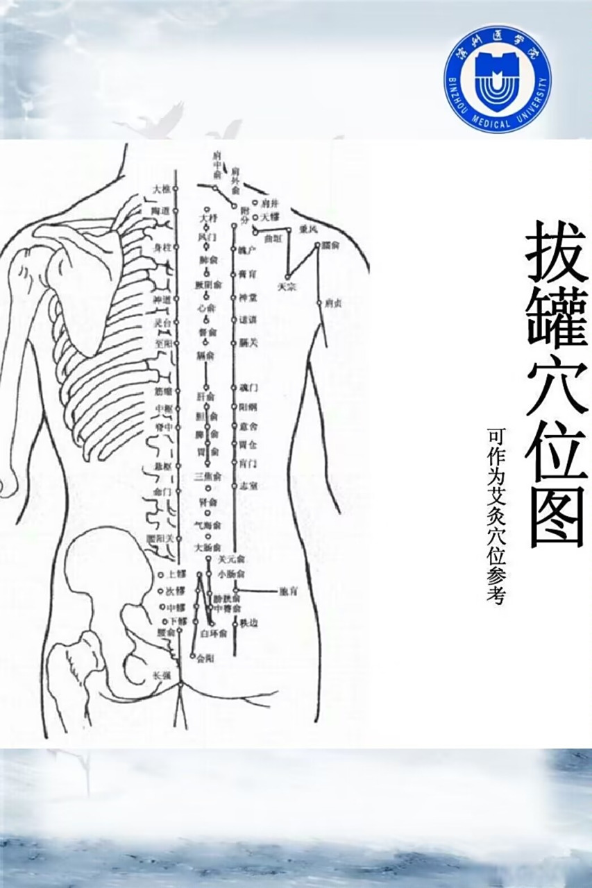 拔罐是一种中医治疗性操作,今天小蜜带