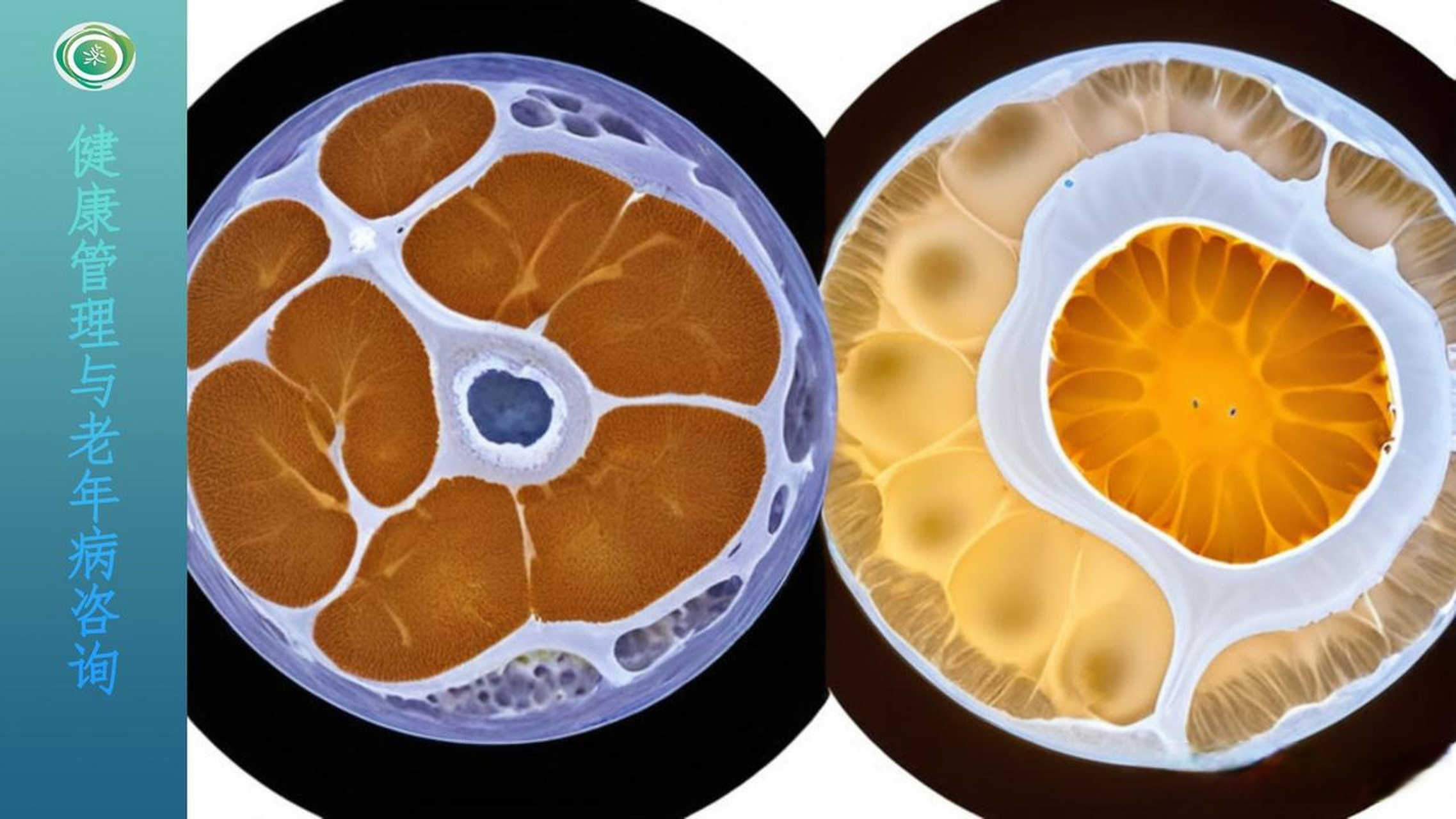 科学家揭示klf15在白色脂肪细胞中的作用,为肥胖治疗开辟新途径 近日