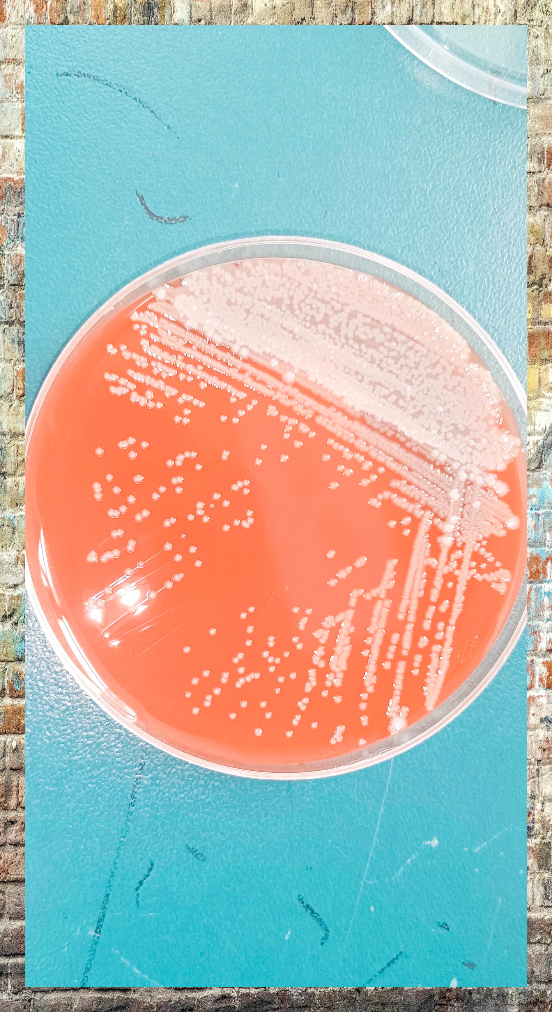 嗜麦芽窄食单胞菌:g