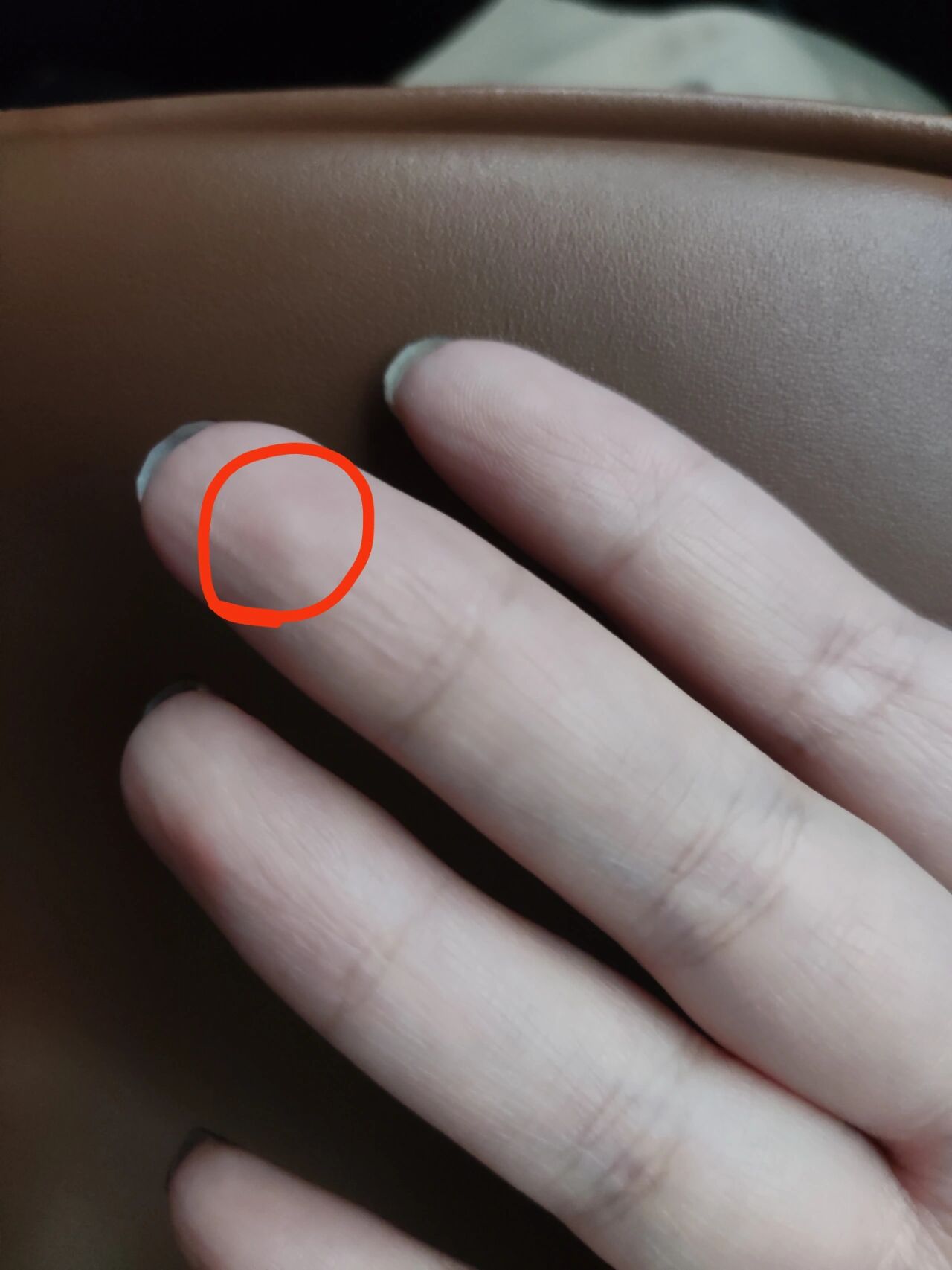 手冷一点右手中指就痛是什么毛病?