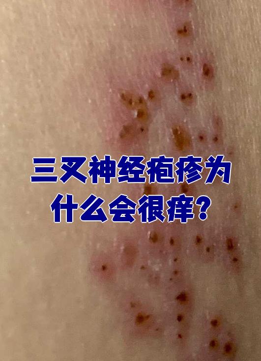  又有什么病毒出现症状(有哪些病毒引起的疾病)