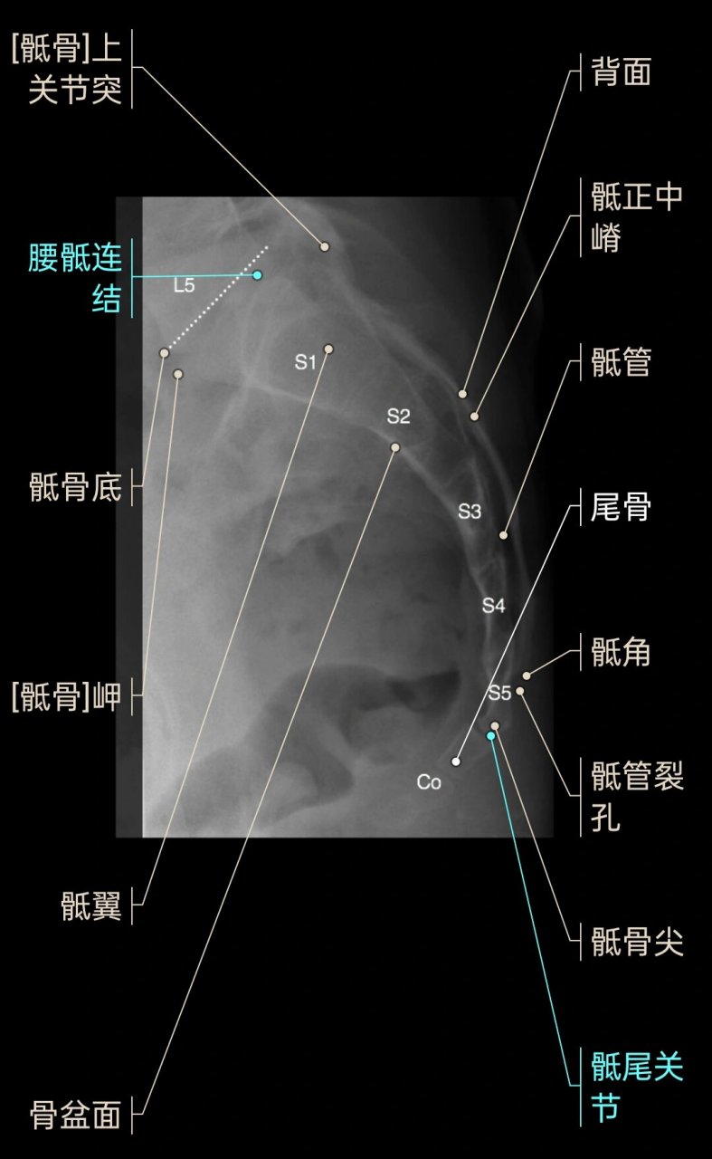 骶尾椎侧位图片