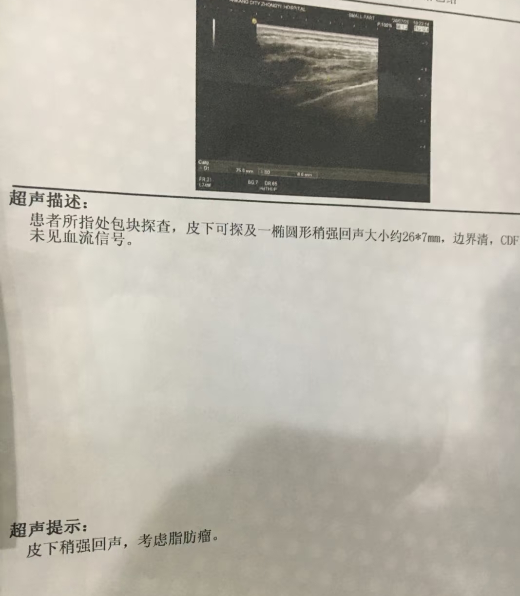 下摸到疙瘩可能由多种原因引起,常见的有胆囊炎,脂肪瘤,皮脂腺囊肿