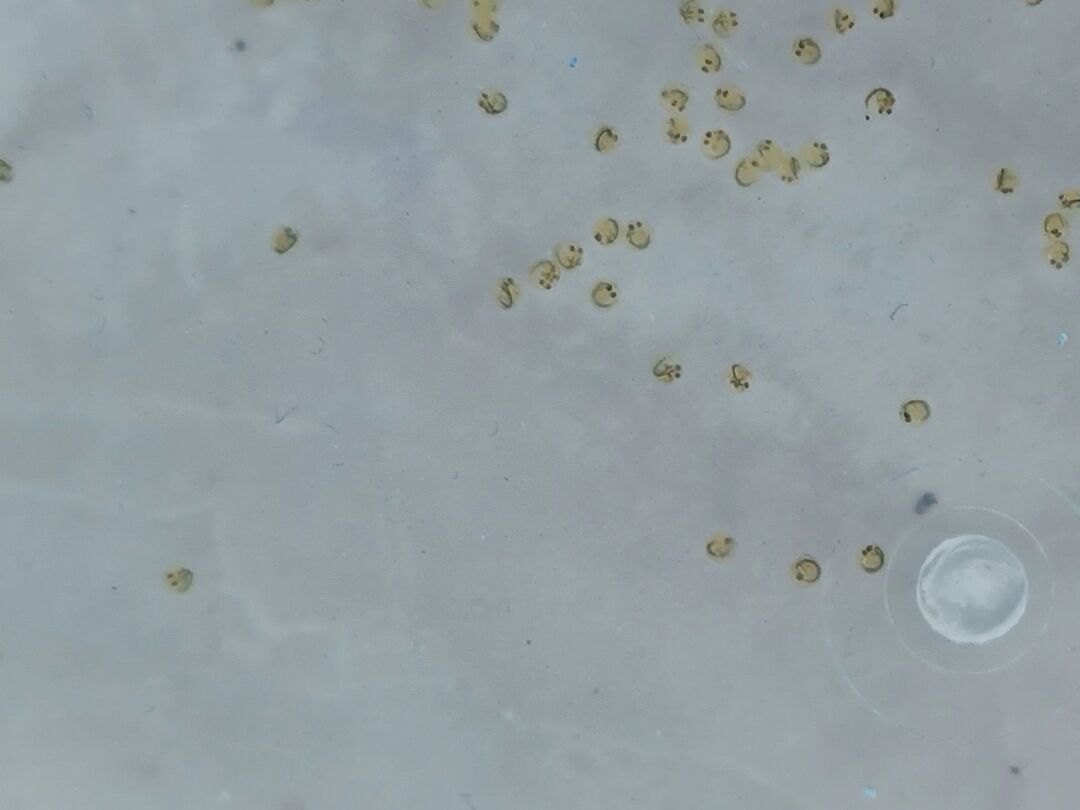 第三天的金鱼卵