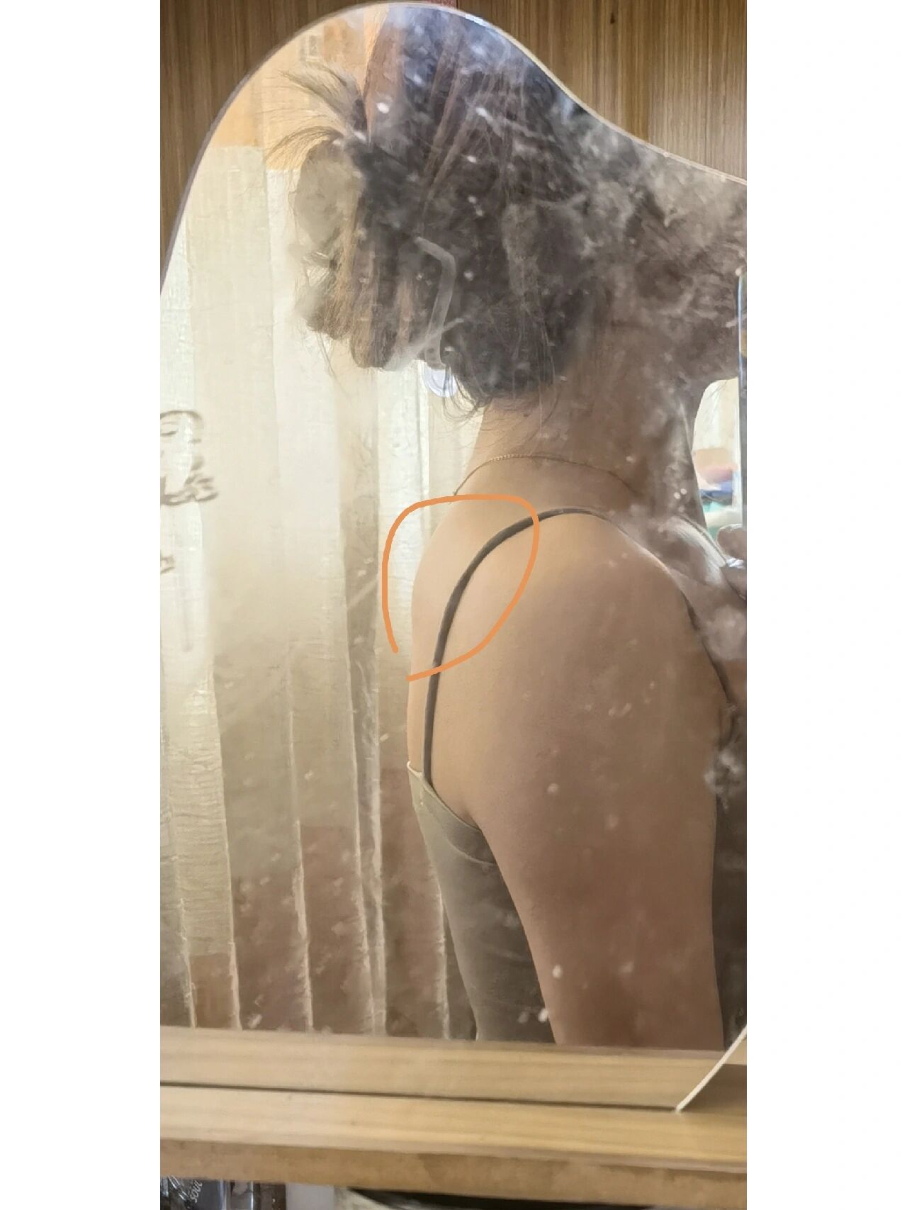 后背这块凸起骨头 怎么拯救! 请问请问,这样的体态要怎么拯救