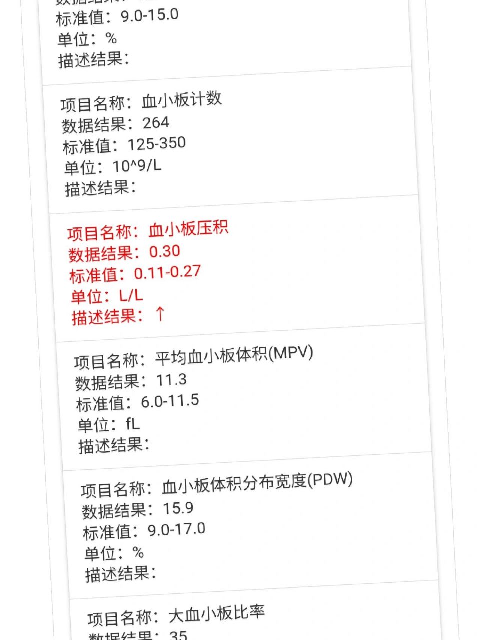 血小板压积偏高是什么情况 血常规血小板压积是什么问题,三年了,没