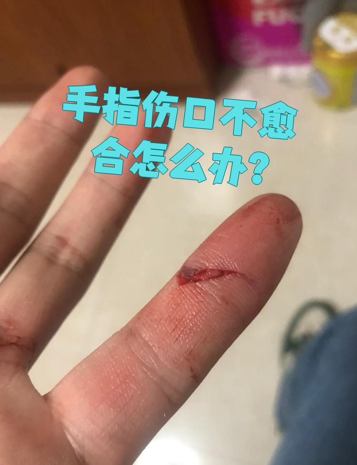 手指伤口不愈合怎么办?