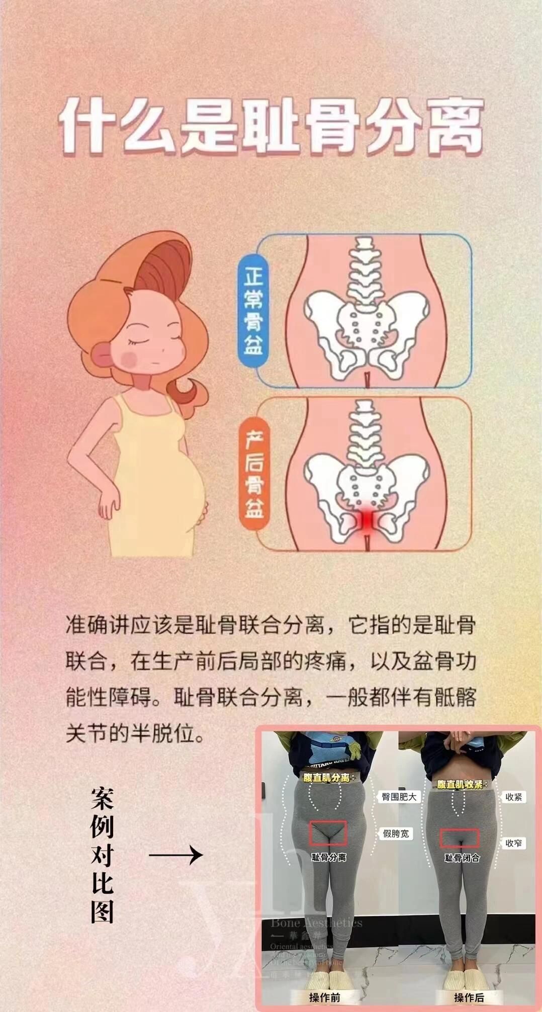 耻骨正常图片