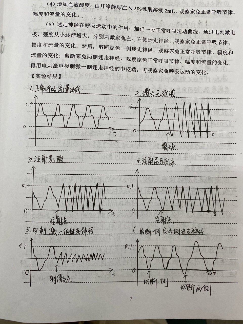 家兔正常血压曲线图图片