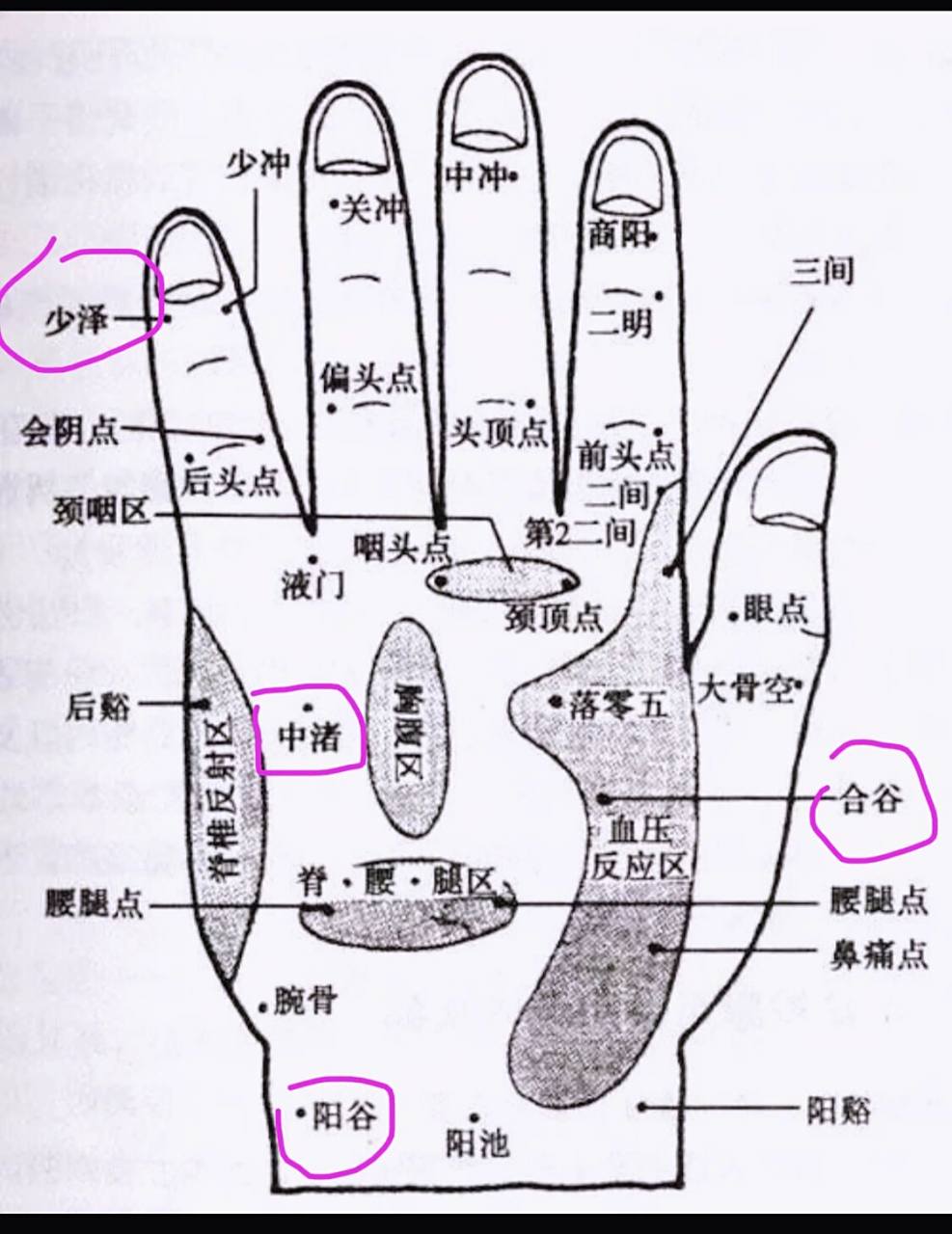 手上的几个穴位,一分钟治耳鸣 94由于耳鸣不是一