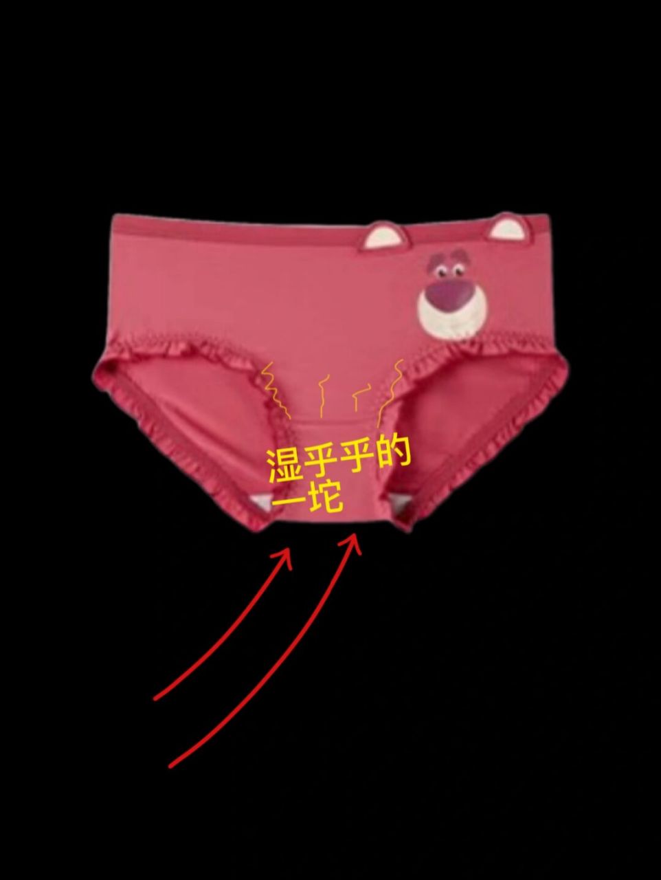 我一直以为我白带量多发黄是妇科问题,为此自卑了很长时间,后面看的