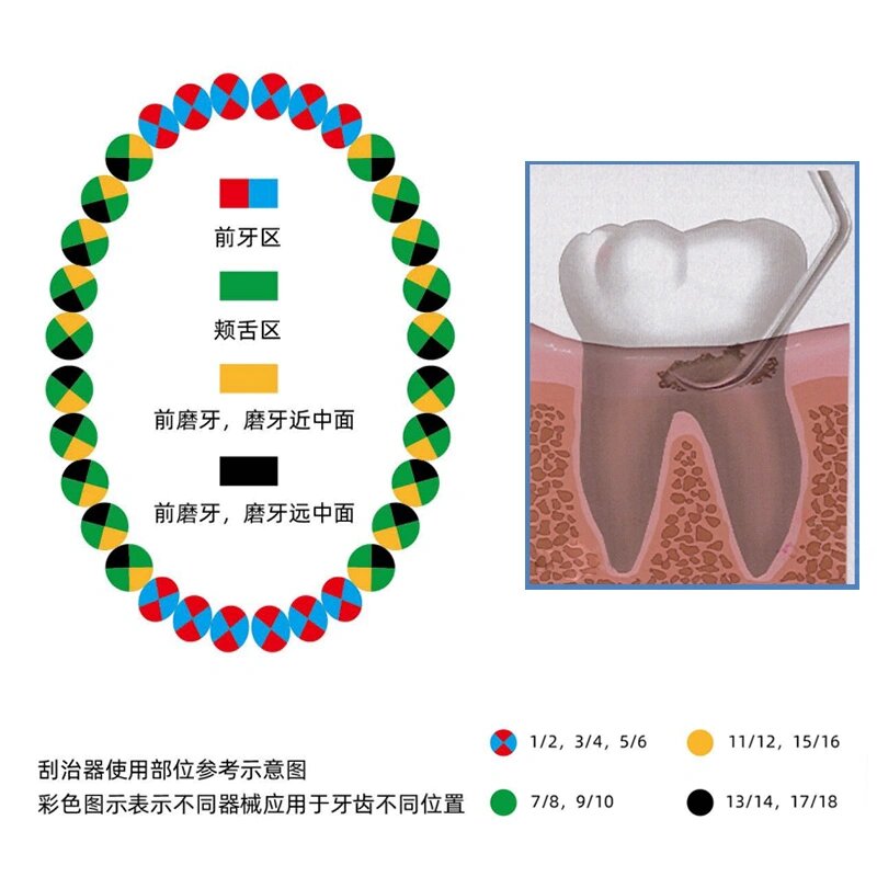 刮治器型号对应牙位图片