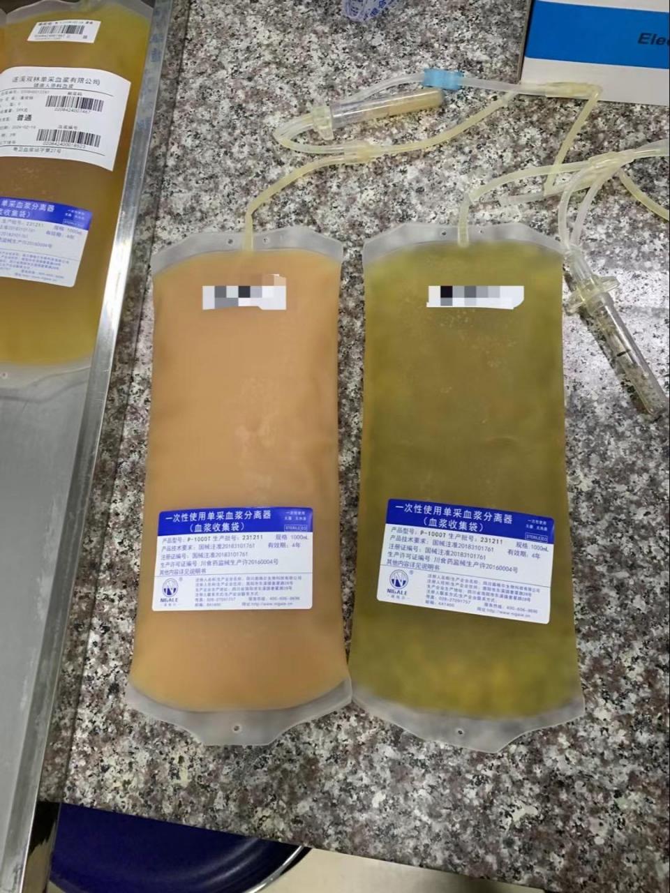 因为每个人的身体状况不一样 所以血浆颜色也不一样 像图31566