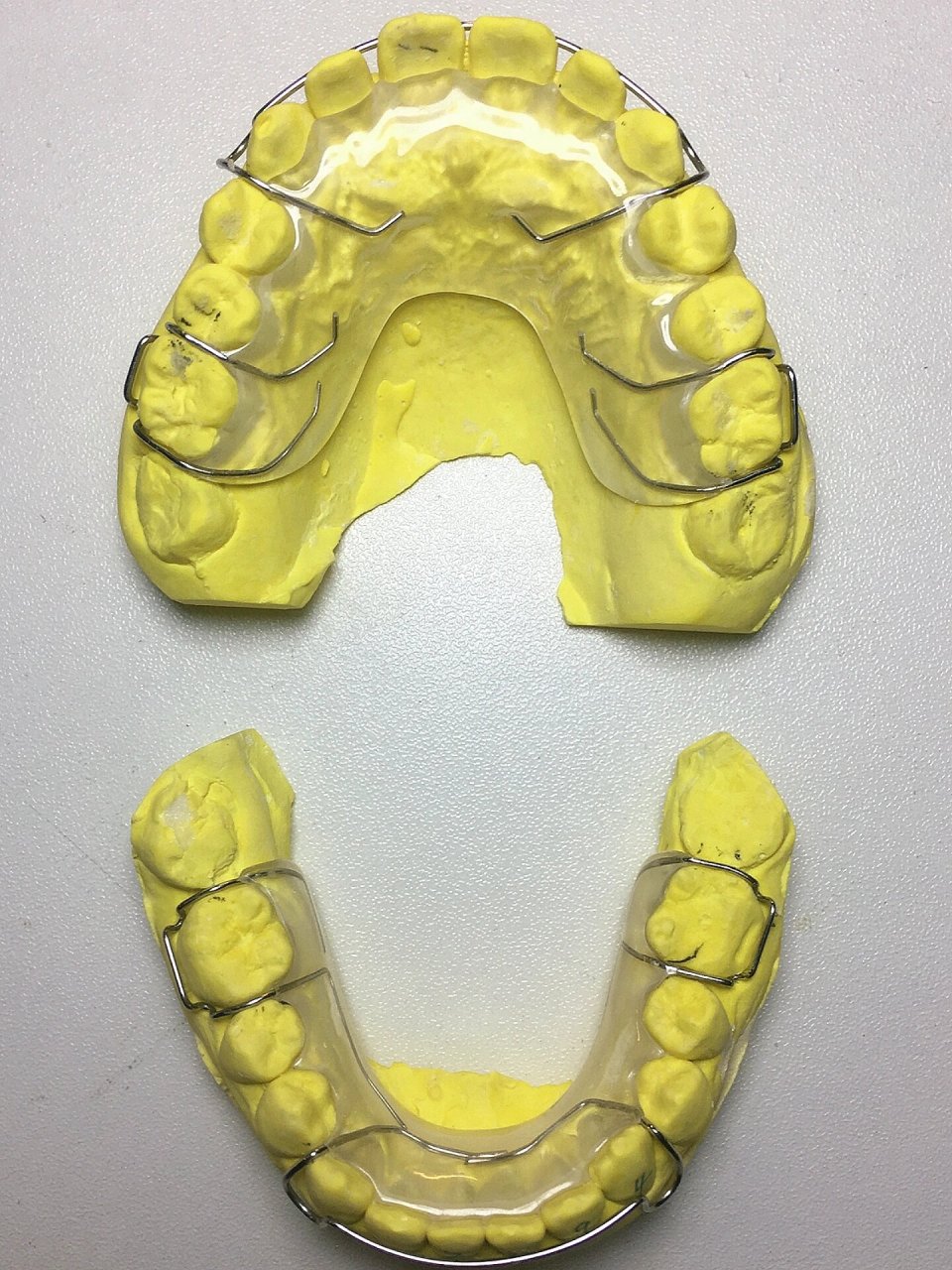 取下哈雷保持器时,应将其放置在专用的矫治器盒子中.