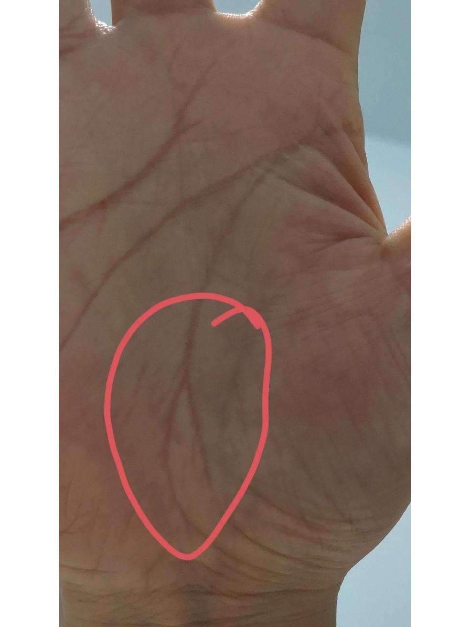 生命线分叉,注意精神方面的疫病 生命线分叉,注意精神方面的疫病